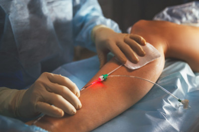 North Shore Vein Treatment Near Me