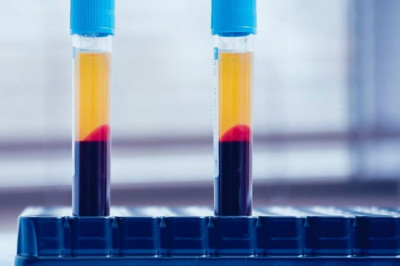 One of the advantages of Platelet rich plasma (PRP) is that it can be used to relieve pain during COVID-19