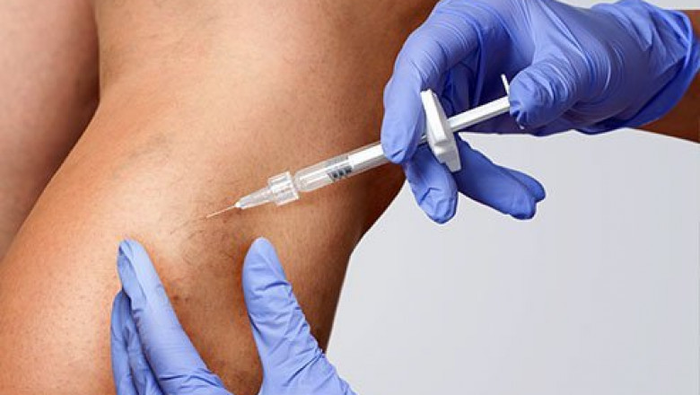 Woodland Park Varicose Vein Treatment Center