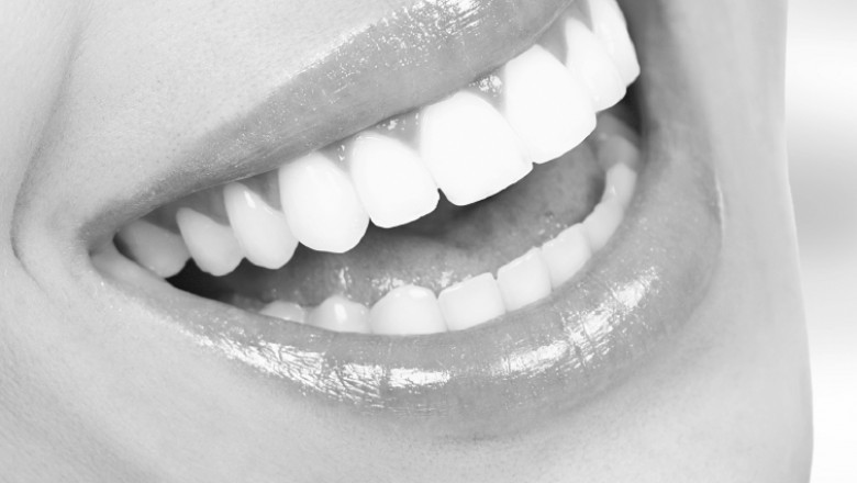 Cost-Effective Teeth Whitening Options for You