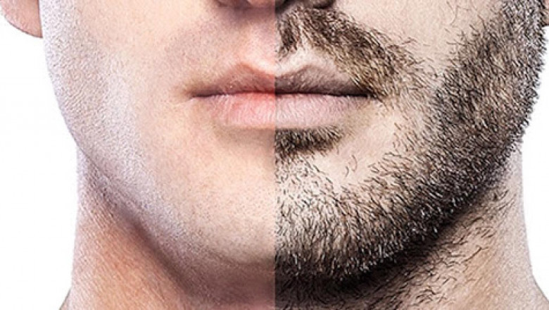 mustache hair transplant