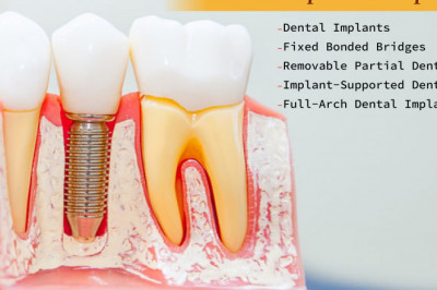 5 Tooth Replacement Options | Emergency Dental Service