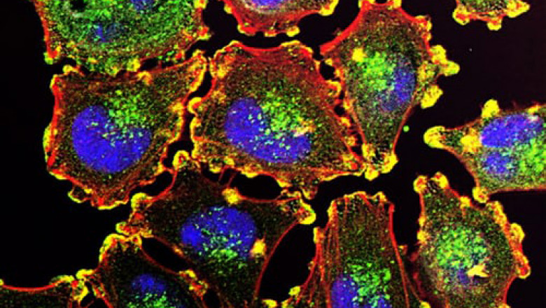 Signs That Cancer Begins in the Body