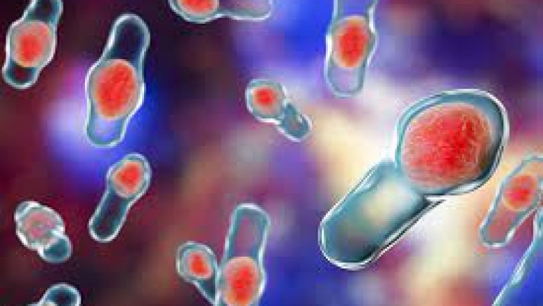 Clostridium Difficile Infection is a bacterial infection caused by Clostridium Difficile. A colonoscopy is used to diagnose the presence of abnormal tissues in the patient's colon
