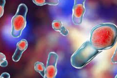 Clostridium Difficile Infection is a bacterial infection caused by Clostridium Difficile. A colonoscopy is used to diagnose the presence of abnormal tissues in the patient's colon