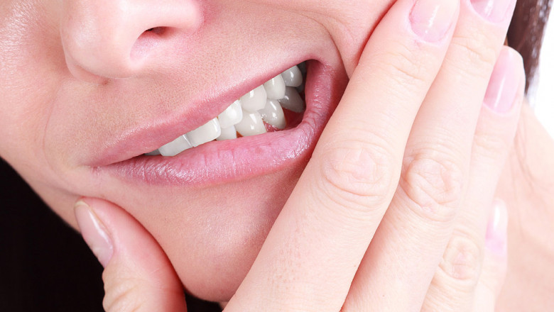 Cosmetic Dental Bonding Treatment