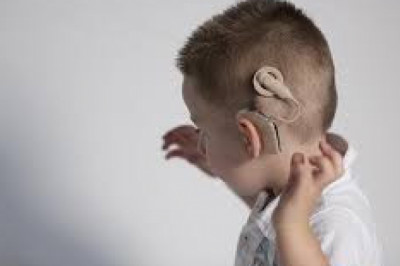 Cochlear Implants: Tiny electronic devices that stimulate cochlear nerves to treat hearing loss
