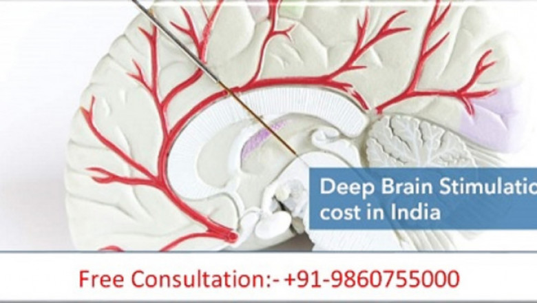 Low Cost Deep Brain Stimulation Surgery in India