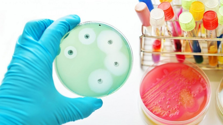 Antimicrobial Susceptibility Testing Market Analysis, Demand, Strategies, Forecast including covid19 Impact