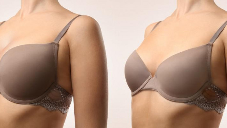 Breast Reduction Surgery in Houston