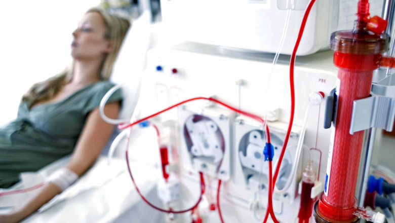 Kidney Dialysis Equipment Strategies, Technological Innovation, Trends & Top Players, Forecast to 2027