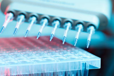 The gene panel is one of the most important tools used in genetic research