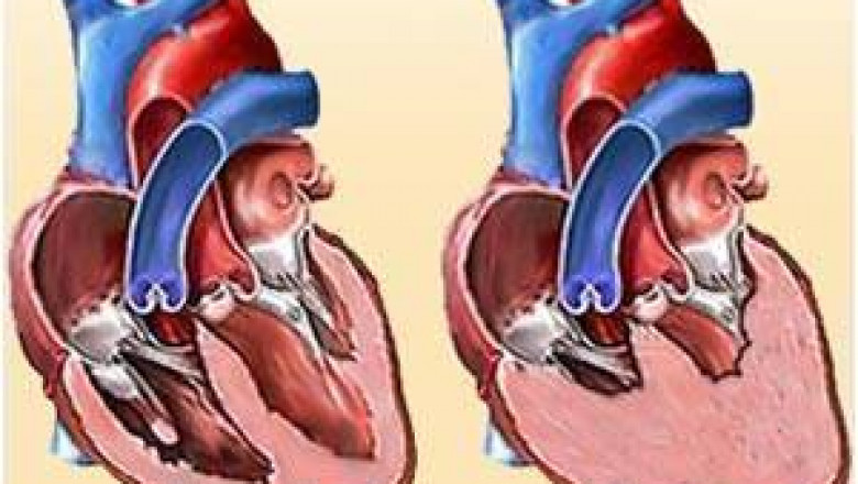 To avoid having long term complications from Congestive Heart Failure Drugs, it is best that you consult your doctor before taking any of these