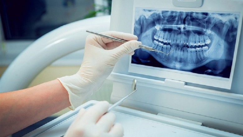 Dental Imaging Market research by dbmr forecast to 2027