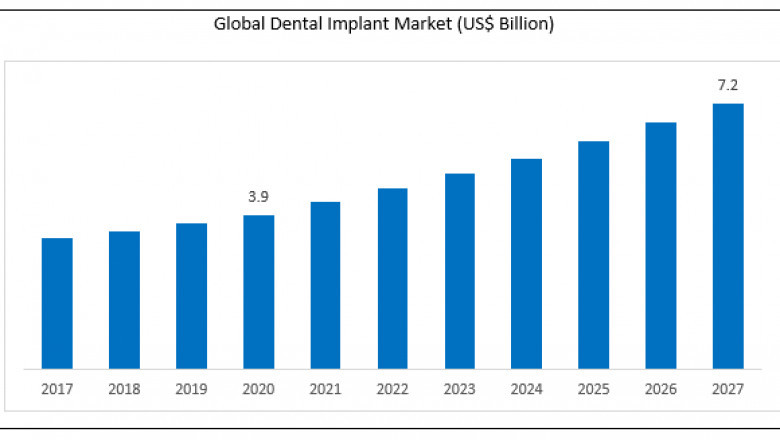 Dental Implant Market 2021 Industry Scenario with Growth Strategies, Market Dynamics, and Competitive Landscape 2027