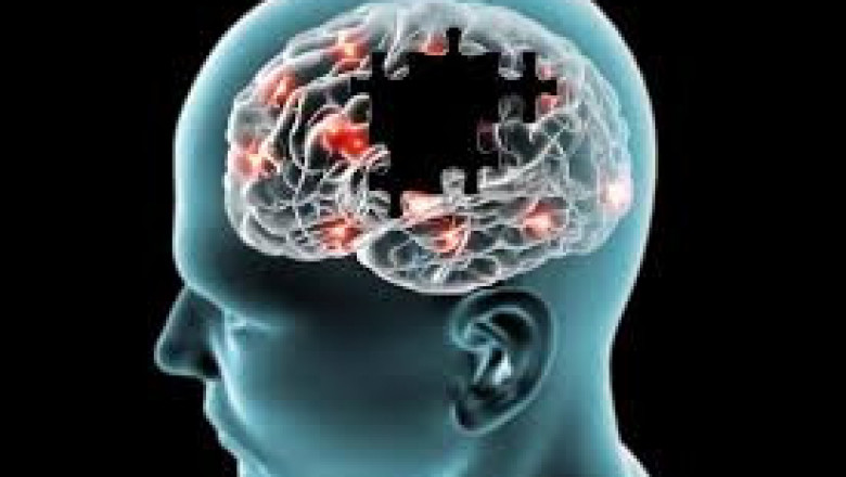 Growth Of Neurodegenerative Disease Treatment Market Projected To Amplify During 2026