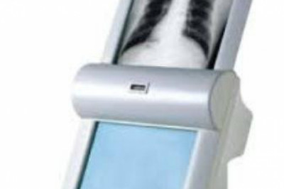 Medical X-Ray Film Processor Market Grows With Changing Consumer Preferences & New Opportunities