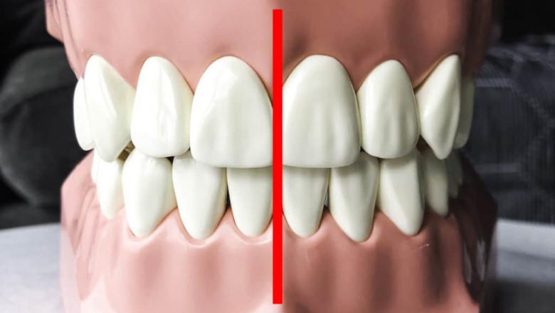 Walk In Dental Clinic Near Me
