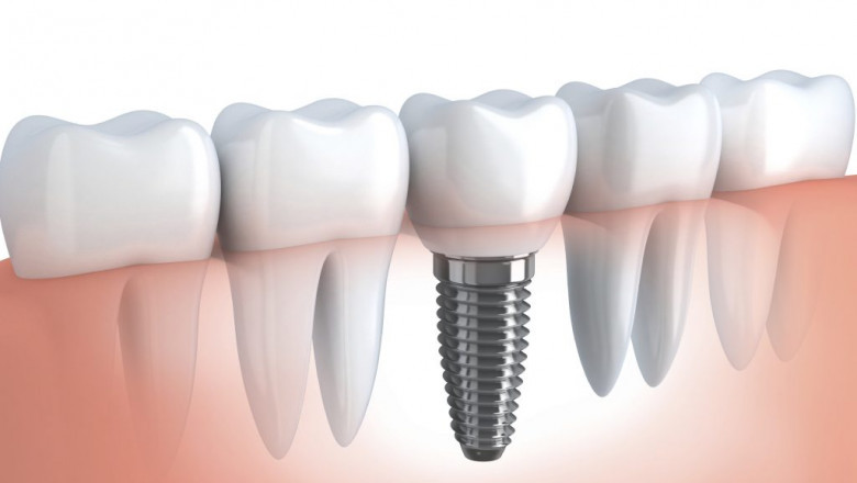 What are the Treatments Available for TMJ?