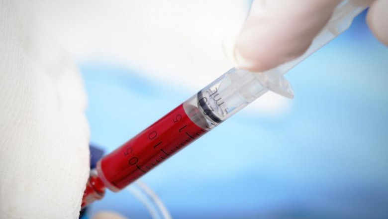 Blood Irradiator Market Development And Growth Forecast By Regions And Applications 2026