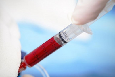 Blood Irradiator Market Development And Growth Forecast By Regions And Applications 2026