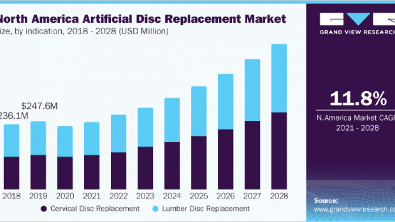 Artificial Disc Replacement Market by Medtronic, Orthofix Medical, Inc.