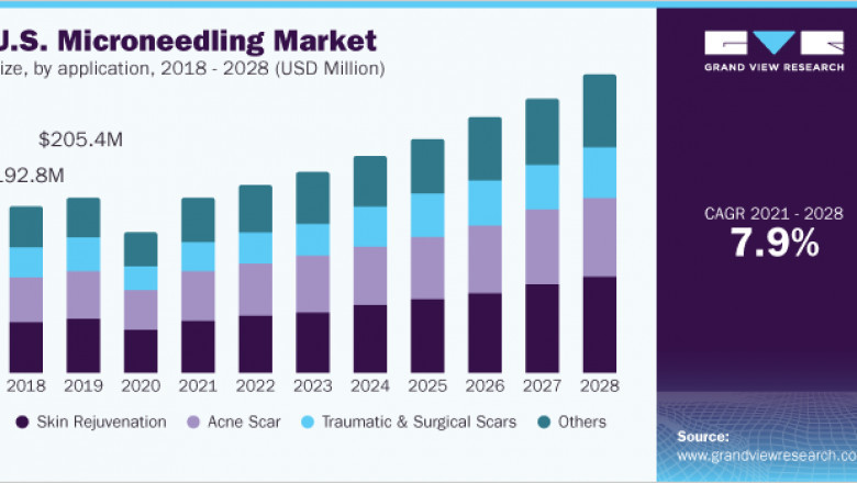 Microneedling Market by Lumenis, Cutera, Cynosure, Endymed Medical