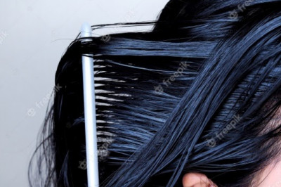 Greasy hair Various causes and solutions available