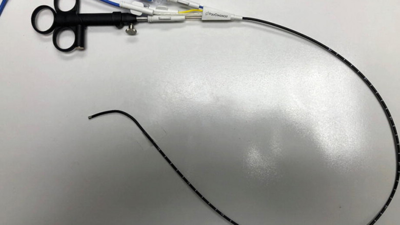 Flexible & Semi-rigid Ureteroscopy Market The Top Trends Impacting its Growth; MRFR Reveals Insights for 2021-2027