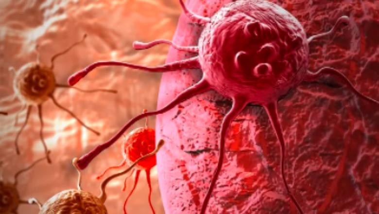 Breast Cancer Diagnostics Market To Reach Valuation Of ~US$ 9 Bn By 2027: Transparency Market Research