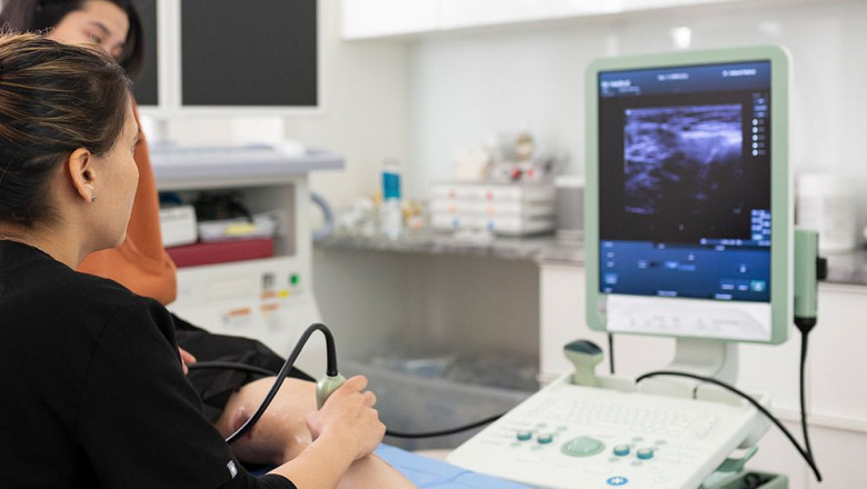 spider vein treatment