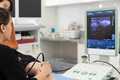 spider vein treatment