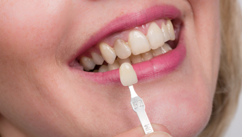 Dental Office In Houston Tx