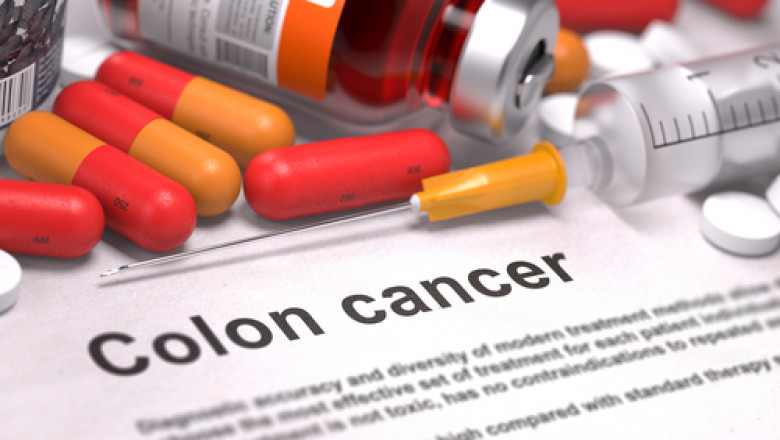 A rise in colon and rectal cancer incidences throughout the world, as well as an increase in research and development studies