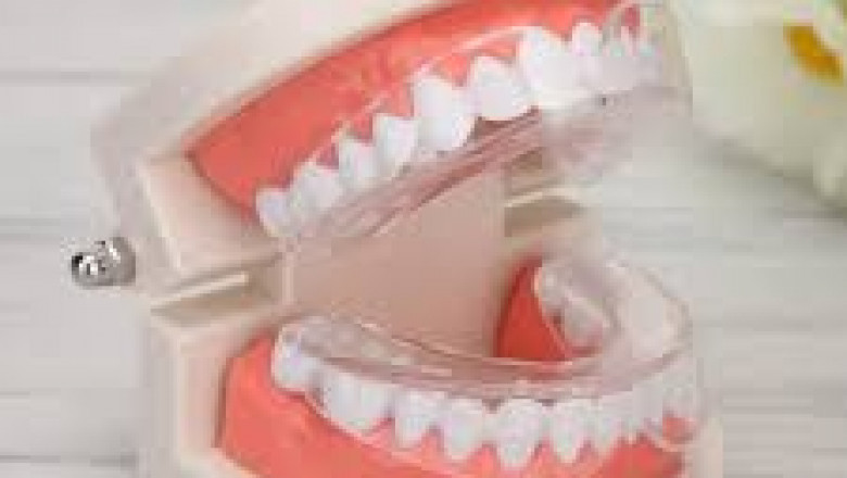 How Cosmetic Bonding and Crown Will Help You?