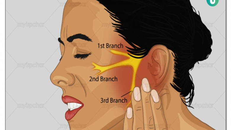 TRIGEMINAL NEURALGIA AND ITS AYURVEDIC TREATMENTS