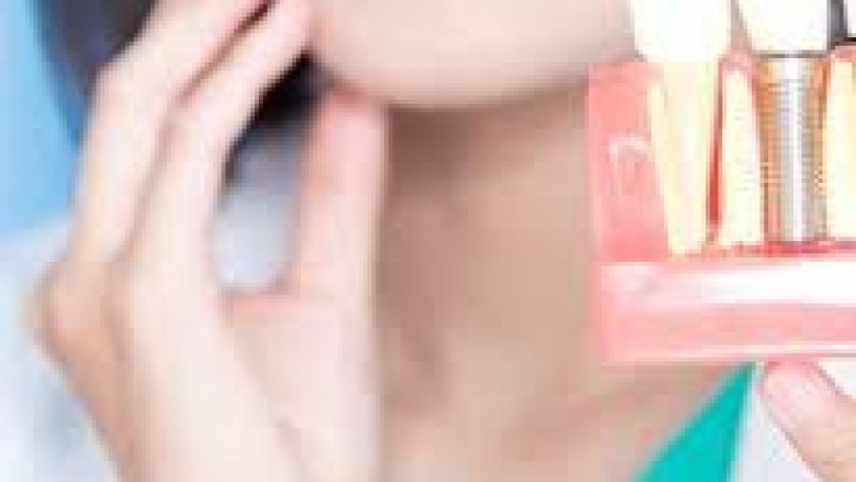 Wisdom Tooth Extraction Singapore