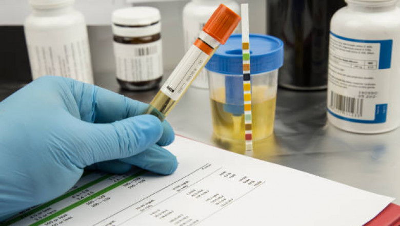Conduct Fentanyl Drug Test Through The Best Fentanyl Test Kit