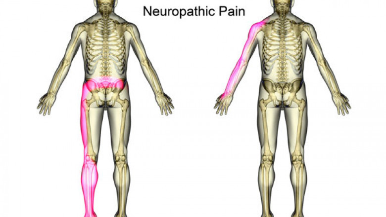 North America Neuropathic Pain Market 2021 Revenue, Opportunity, Forecast and Value Chain 2028