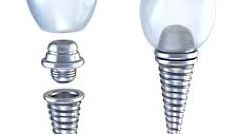 Low-Cost Cosmetic Teeth Whitening