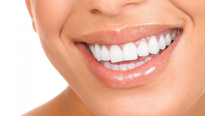 What Is A Laser Gingivectomy?