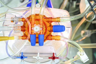 Medical Tubing Market - Global Company Analysis, Size, Share, Growth, Trends and Forecast 2018 - 2026