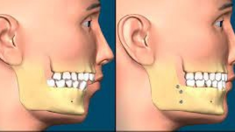 Plastic Surgery: A Change to Your Identity!