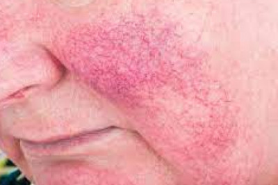 Why Vitamin C is good for skin
