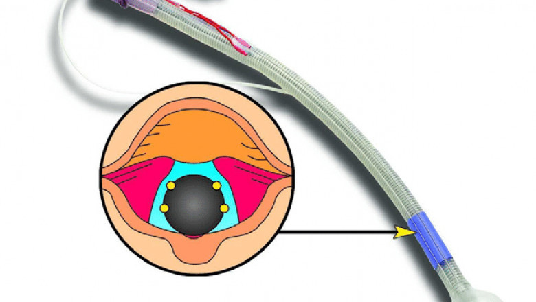 Intraoperative Monitoring Electrodes Market - GROWTH, TRENDS, COVID-19 IMPACT, AND FORECASTS (2021 - 2026)