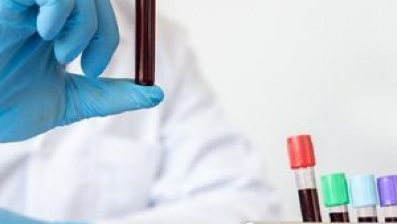 Automated Cell Culture Market to Record Significant Incremental Dollar Opportunity Forecast to 2027