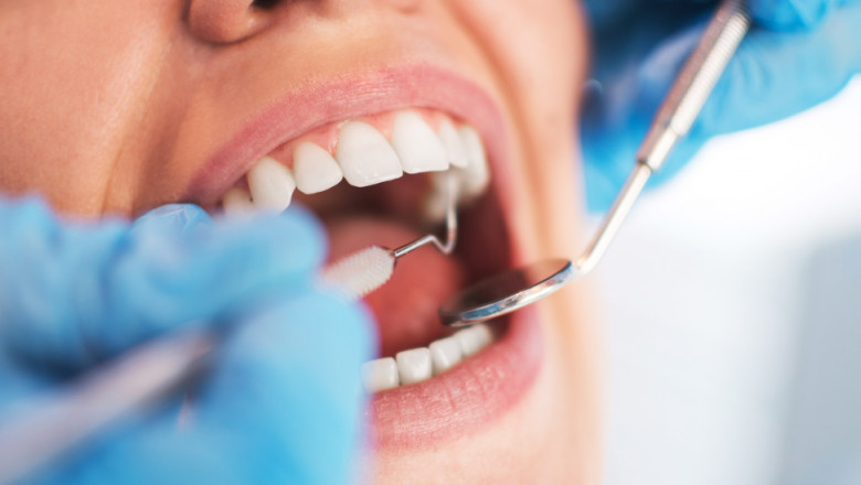 Dental Emergencies Seen Same Day