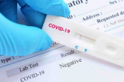The Day 2 Antigen Test: What To Expect And When To Know If You're Pregnant