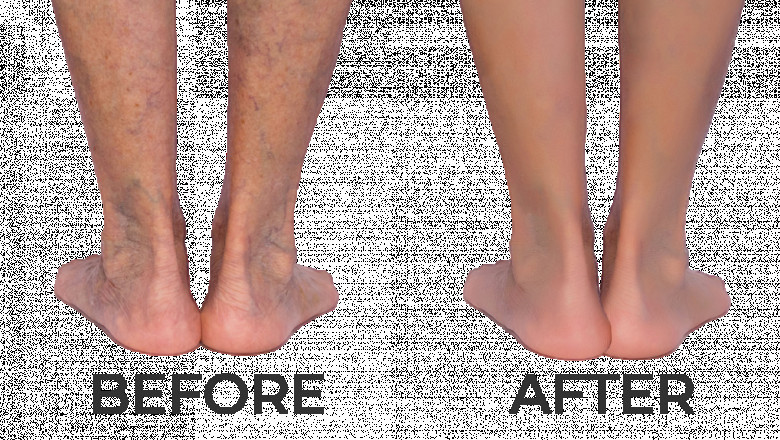 What Are The Prominent Causes Of Venous Disorders?