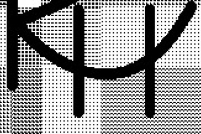 Braces in Mack -  Haverkos Reddy Orthodontics